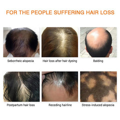 Grospe Hair Growth Essence Oil dropper illustrating deep root nourishment for healthier hair