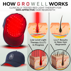 GroWell laser-LED panel uses precision micro-lenses across the scalp.
