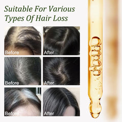 Scalp massage with Gypsophila Batana Oil for healthy roots.