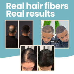 Hair Illusion applying on thinning area to create a fuller silhouette
