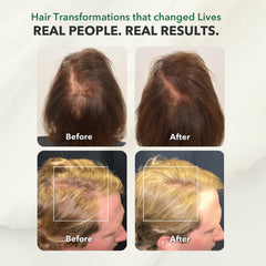 HairSmart wheat germ and jojoba oil provide nourishing volume.