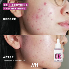 Handmade Heroes Bakuchiol oil application on neck demonstrates silky texture and gentle absorption.