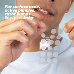 Hanhoo blemish patch shown on skin demonstrates invisible protection.