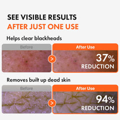 Deep pore cleansing with Hanskin AHA Pore Cleansing Oil and plant oils.