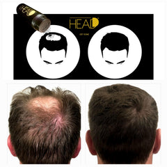 HEADD before-after image highlights natural-looking hair thickening