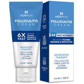 Hermon Folliculitis Cream tube ready for daily use on skin.