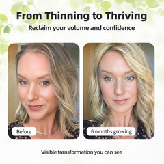 HiPlus pineapple-flavored gummies texture suggests tasty daily habit for hair wellness