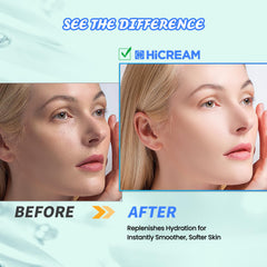 Hicream Hyaluronic Acid serum bottle emphasizes deep hydration.
