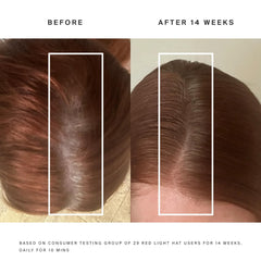 HigherDOSE red light hat worn during morning routine improves scalp comfort.