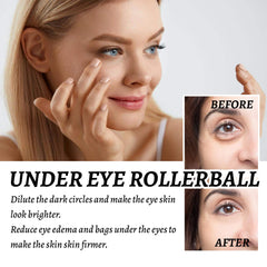 HOYGI eye roller technique demonstrates even distribution around the eye contour.