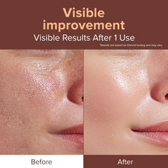 ID PLACOSMETICS Exosome Serum pump delivers a silky, texture-smoothing application.