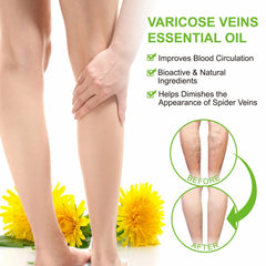 IKZEE Varicose Veins Essential Oil dropper for precise daily application