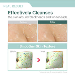 Illiyoon Gentle Deep Cleansing Oil on a porcelain dish, simple skincare ritual.