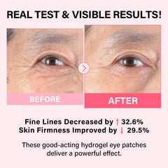 IMETHOD PDRN Eye Patch applied under-eye area to illustrate cool, calming relief.