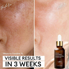 Inblair Rejuvenate serum texture close-up shows lightweight finish.