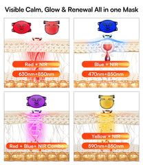 INIA LED panel with 228 chips for uniform light diffusion.