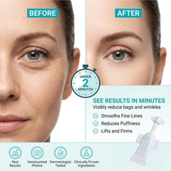 Instantly Ageless wrinkle reducer tightening facial skin for a refreshed look.