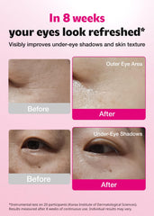 ISOI blemish care under-eye patch texture shows cooling hydration for tired eyes