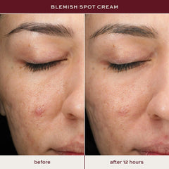 ITK Skincare back and body blemish treatment shown in use context.