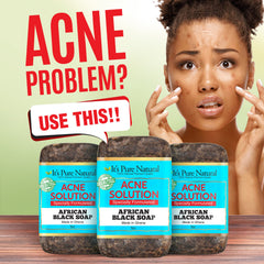 It's Pure Natural African Black Soap bars closeup showing natural ingredients
