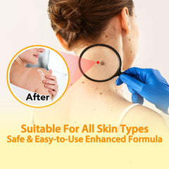 ITSDAWN Bee Venom Cream applied to skin for soothing daily moisture.