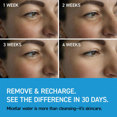 IVOSKIN micellar water applied on the face for a gentle cleanse.