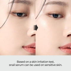 Hands applying JMsolution Skin Boost Snail 97% Serum on cheek for quick absorption.