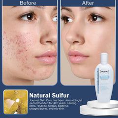 JOESOEF SKIN CARE anti-acne lotion texture and usage