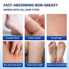 JYOVQXF aloe and hyaluronic moisture boost for dry feet.