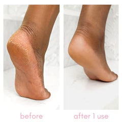 Kiara Sky Heeling Callus Remover Set application brush enables targeted treatment on heels
