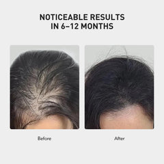 KINTOR spray application captures easy daily use and quick absorption.