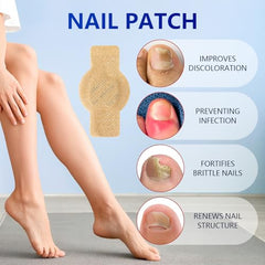 Kosimi Nail Patches Brittle Nails: strengthens appearance with patch coverage