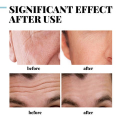 KUQAA Retinol Face Cream for Men daily use demonstrates quick absorption.