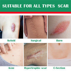 Ladygo Advance Scar Gel bottle on white background highlights dermatologist-recommended scar treatment