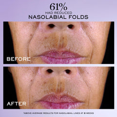 Lancôme Rénergie C.R.x application demo illustrating simple nightly use.