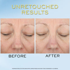 Lancôme Supra Screen SPF 50+ logo close-up communicates broad protection.