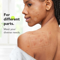 LitBear 12mm patch protects mid-sized zits with strong absorption.