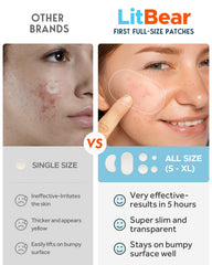 LitBear 14mm acne patch on a bigger breakout for full-coverage care