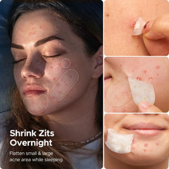 LitBear patches in 8-12mm sizes for small pimples and clusters