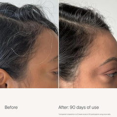 Applying Living Proof Density Serum to the scalp during daily routine.