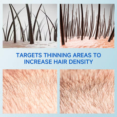 Loreviya dormant follicles support serum visualizing scalp nourishment.