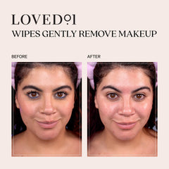 Loved01 oil-free fragrance-free wipes suited for sensitive blemish-prone skin