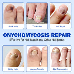 LTQXGT nail repair glue provides strong adhesion for cracks and chips.
