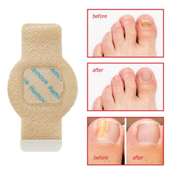LTQXGT toenail treatment extra-strength for resilient, healthier looking nails.
