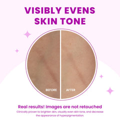 Lume aluminum-free formula supports skin safety for external use.