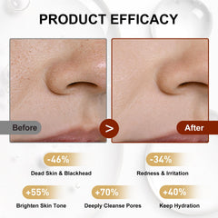 Lynz Pure Peel Shot Glow Niacinamide ampoule close-up, pore refinement benefits.