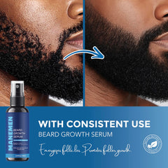 MANEMEN saw-palmetto-rosemary formula shows fortified beard roots.
