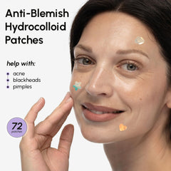 MAREE Star Pimple Patches being applied on blemish for discreet wear.