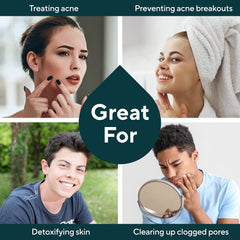 Marie Originals Acne Bar Soap packaging emphasizes USA craft and natural ingredients