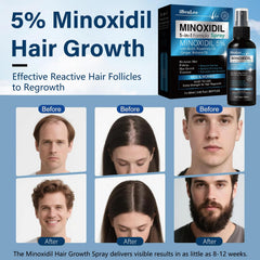 Mayferte Minoxidil spray in action for home use